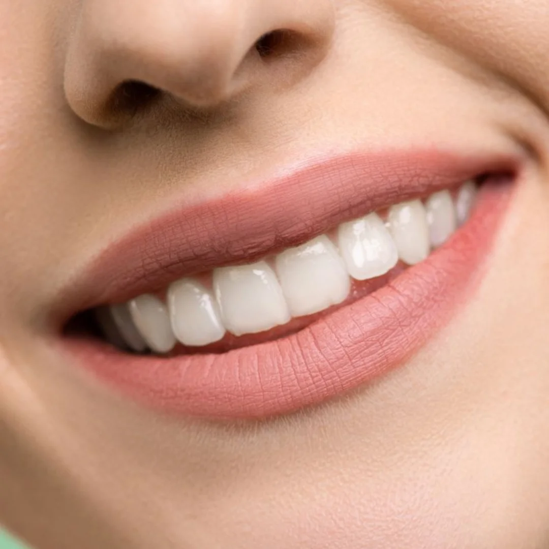 Smile Gallery