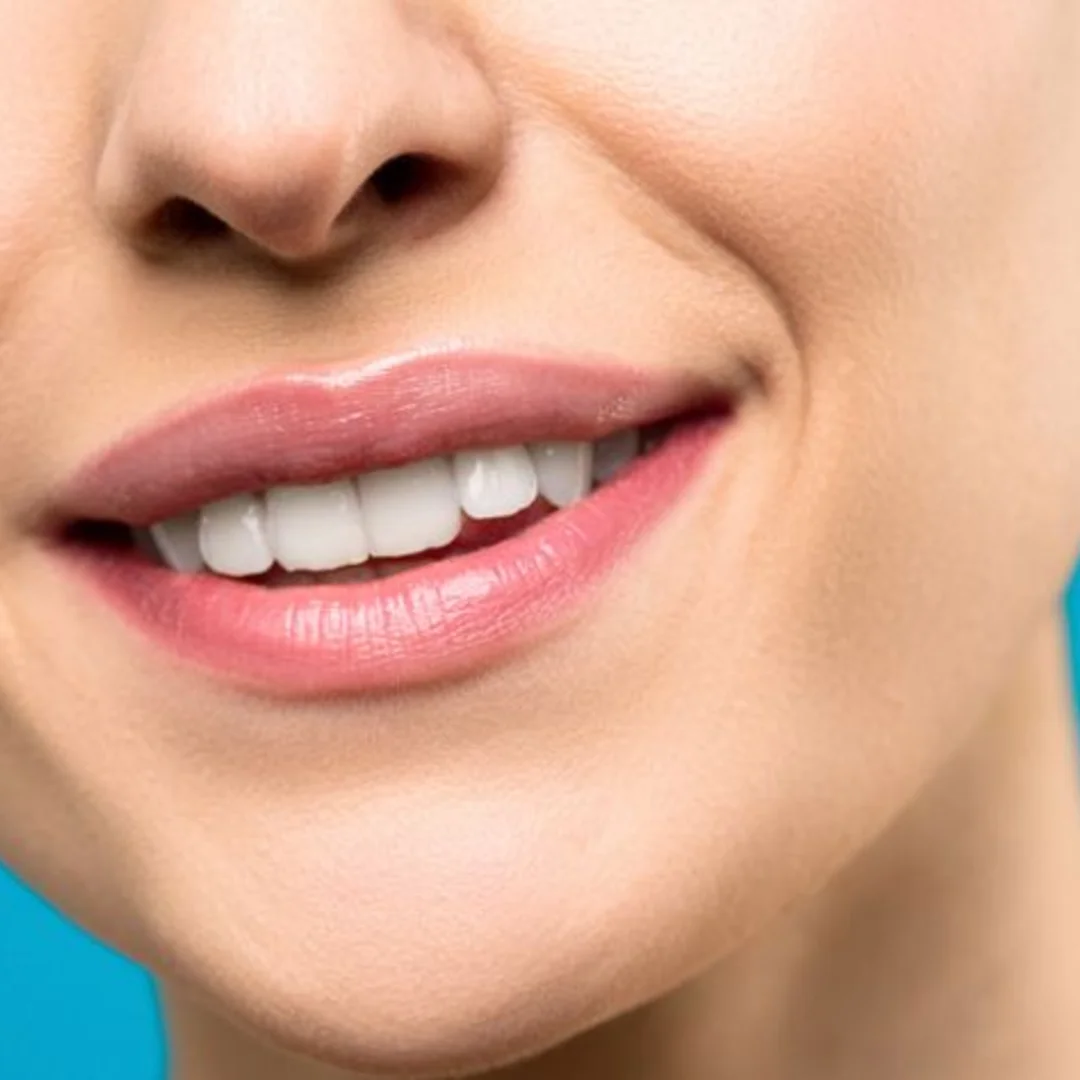 Smile Gallery