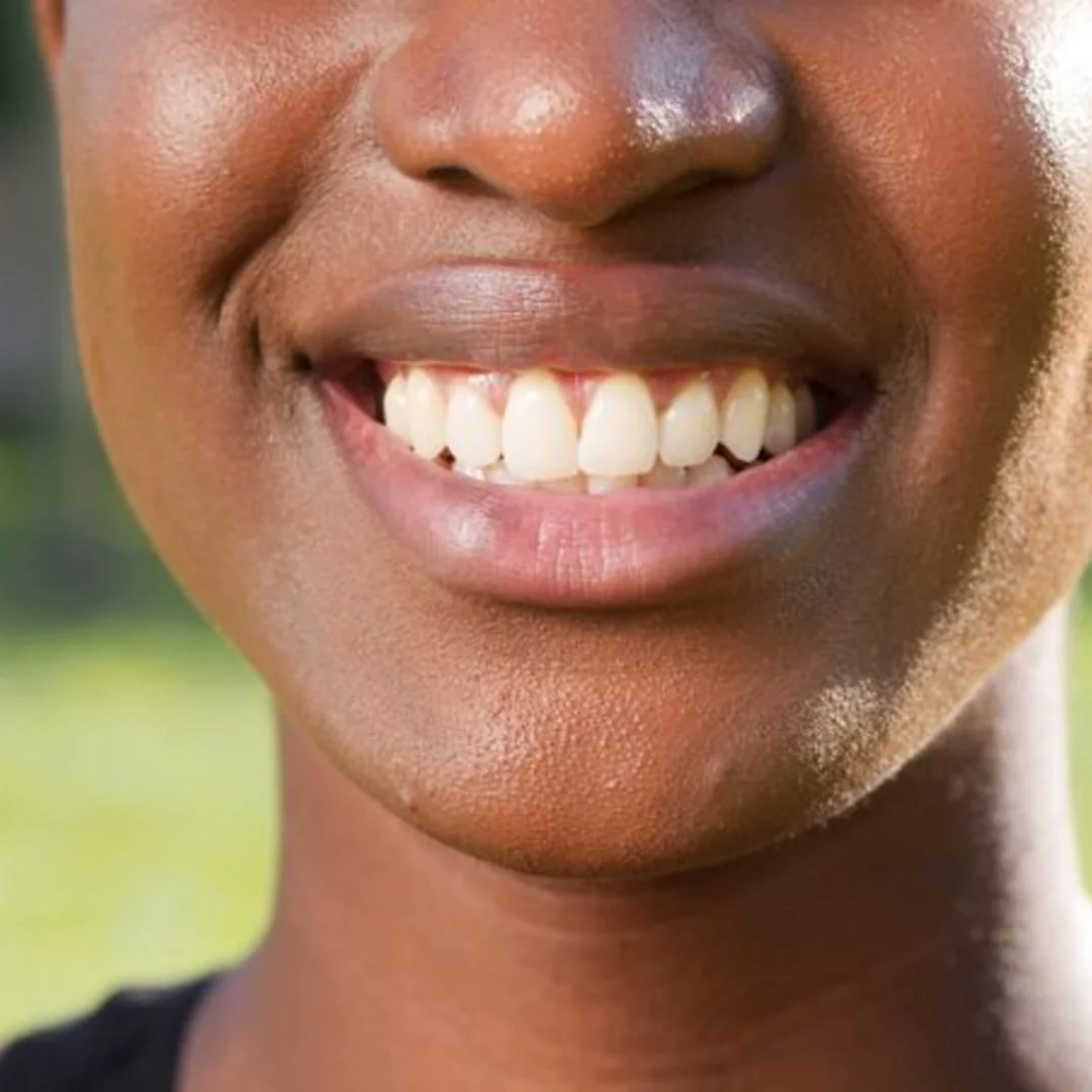 Smile Gallery